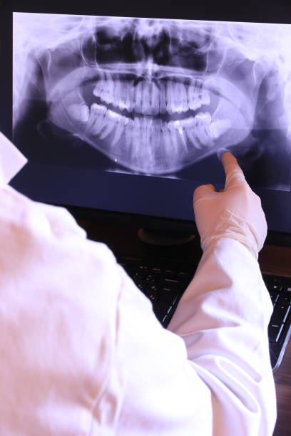 Best Emergency Dental Care for Broken or Chipped Teeth in China Grove, NC