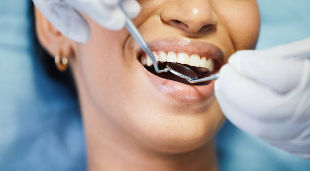 Best Emergency Tooth Extraction in China Grove, NC