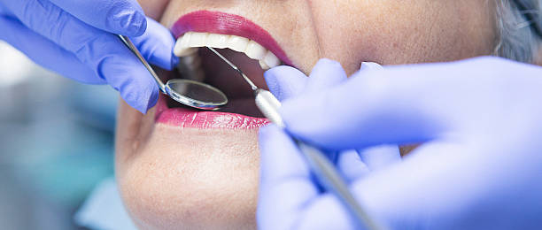 Best Emergency Tooth Extraction in China Grove, NC